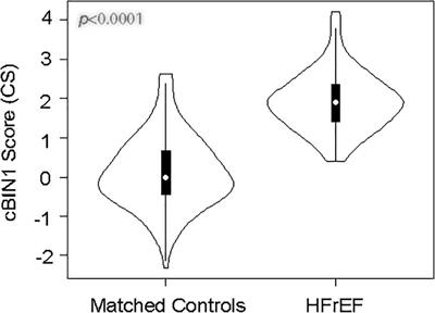 cBIN1 Score (CS) Identifies Ambulatory HFrEF Patients and Predicts Cardiovascular Events